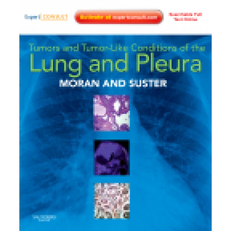 Tumors and Tumor-like Conditions of the Lung and Pleura
