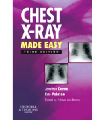 Chest X-Ray Made Easy, 3rd Edition