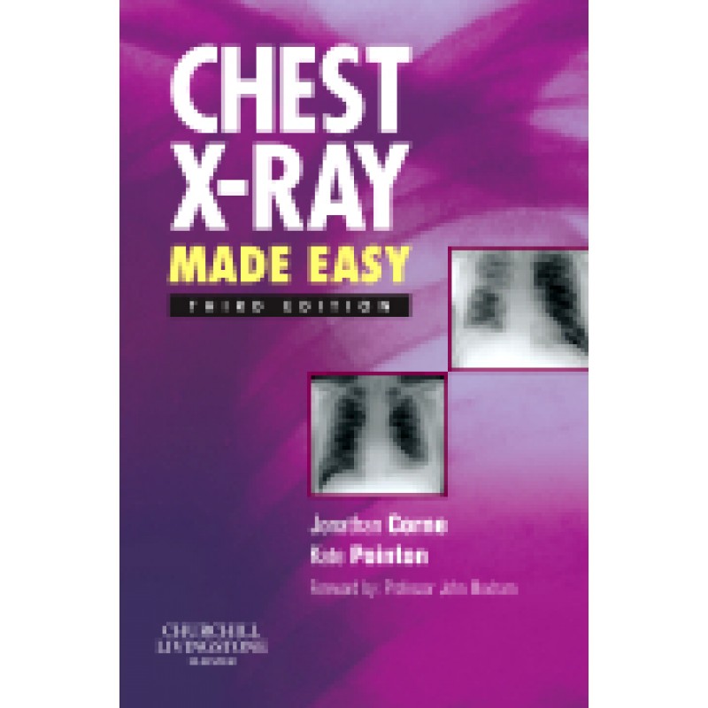 Chest X-Ray Made Easy, 3rd Edition
