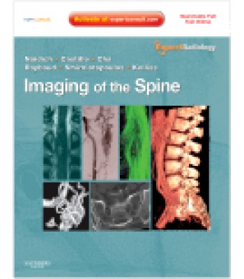 Imaging of the Spine Expert Radiology Series, Expert Consult-Online and Print