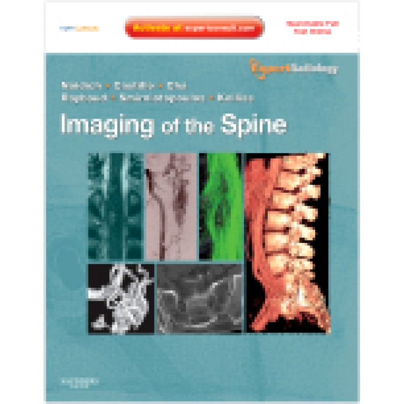 Imaging of the Spine Expert Radiology Series, Expert Consult-Online and Print