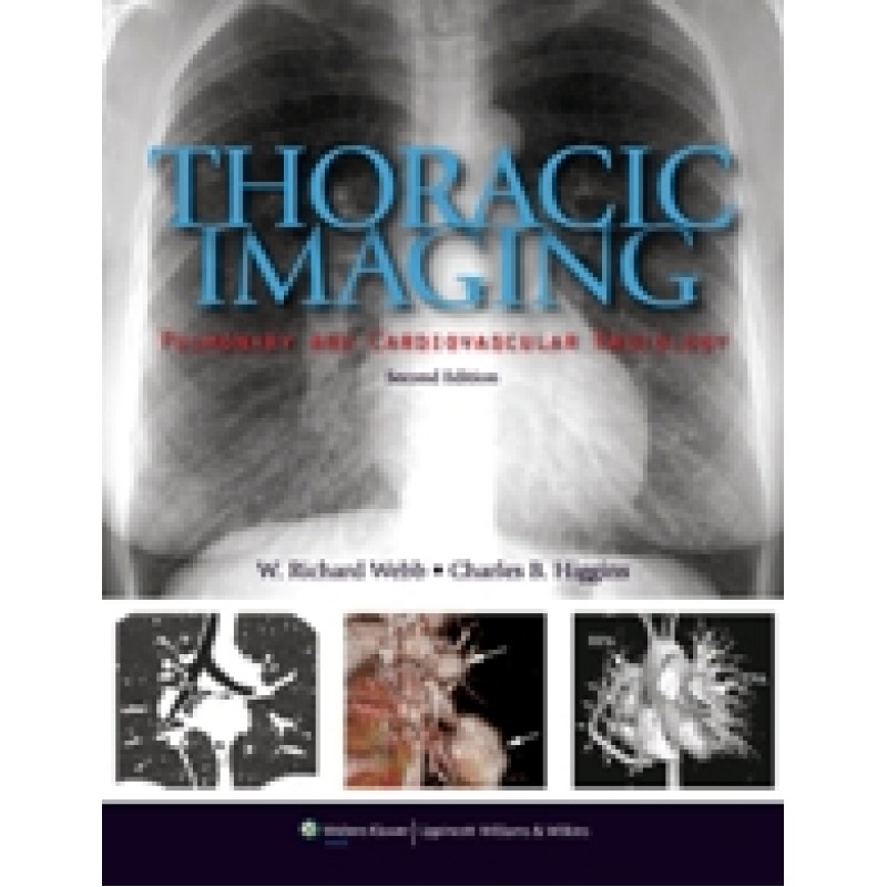 Thoracic Imaging: Pulmonary and Cardiovascular Radiology, 2/e