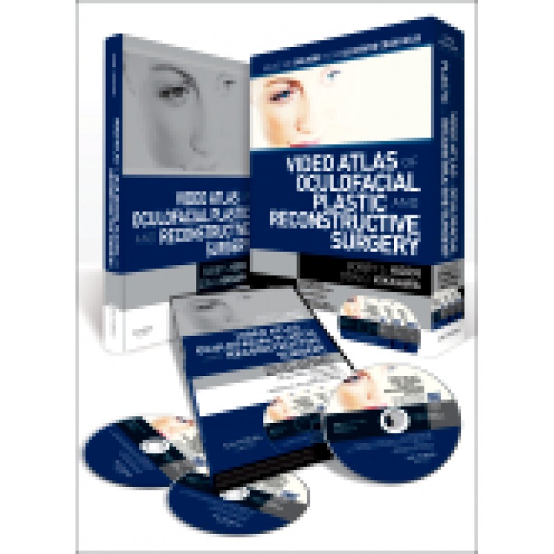 Video Atlas of Oculofacial Plastic and Reconstructive Surgery - DVD with Text