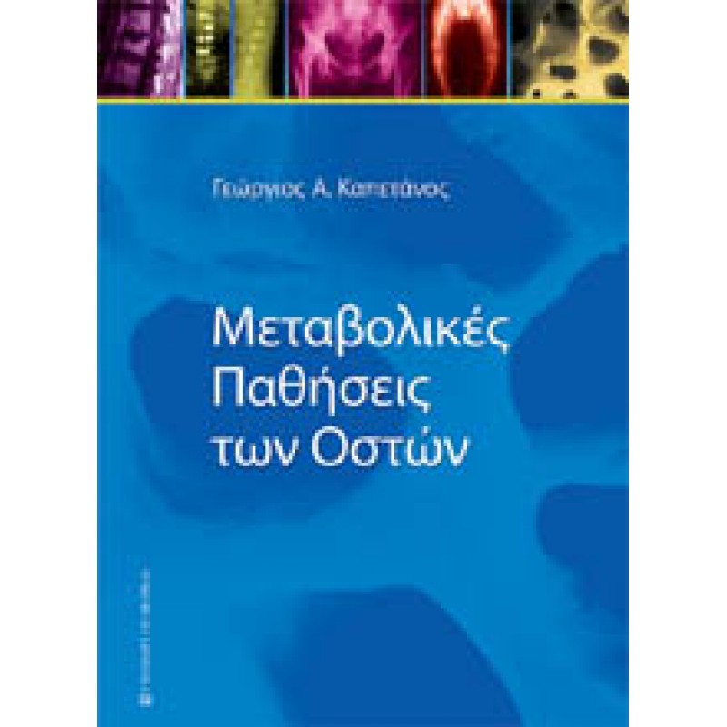 ΜΕΤΑΒΟΛΙΚΕΣ ΠΑΘΗΣΕΙΣ ΤΩΝ ΟΣΤΩΝ