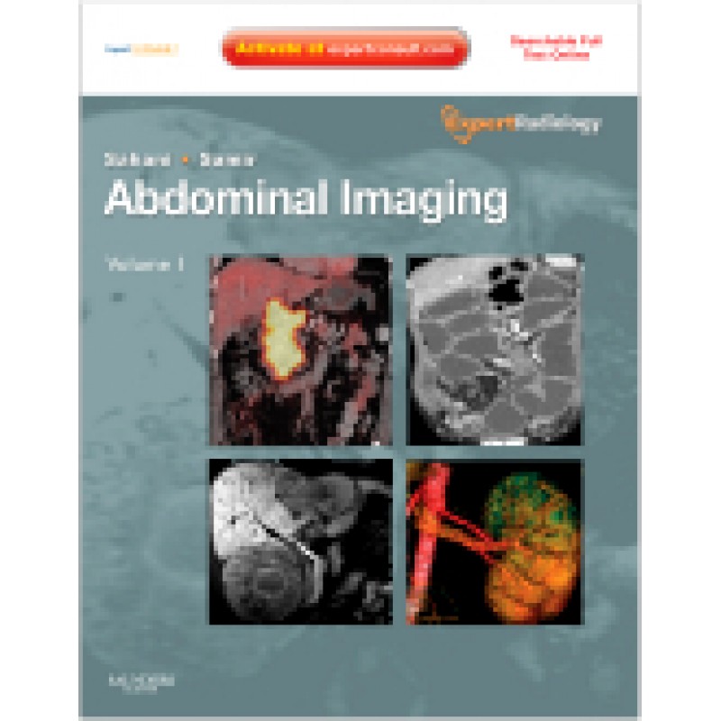 Abdominal Imaging, 2-Volume Set Expert Consult- Online and Print