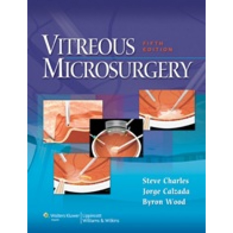 Vitreous Microsurgery , 5/e