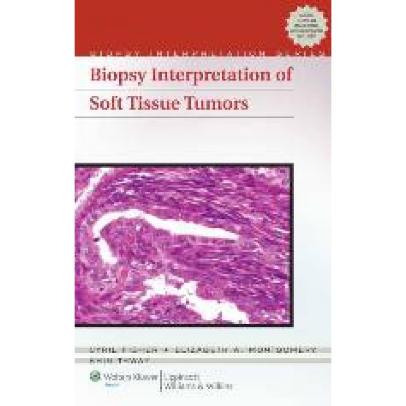 Biopsy Interpretation of Soft Tissue Tumors