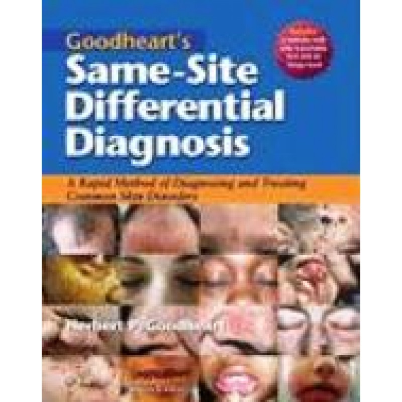 Goodheart's Same-Site Differential Diagnosis: A Rapid Method of Diagnosing Common Skin Disorders
