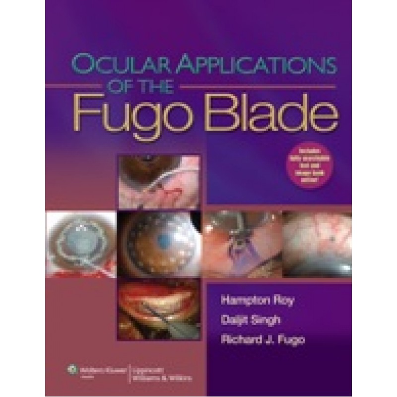 Ocular Applications of Fugo Blade