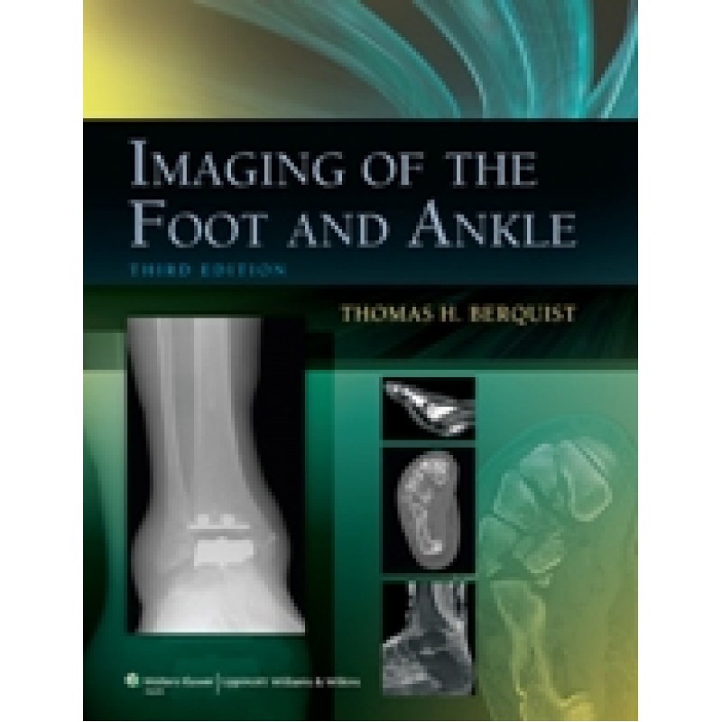 Imaging of the Foot and Ankle, 3E