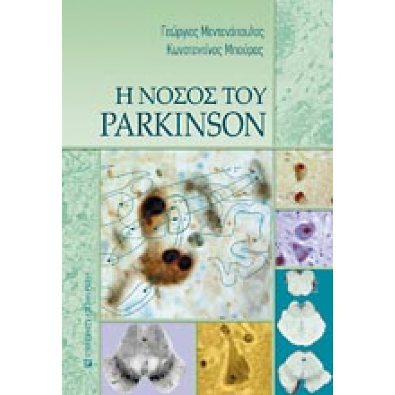 Η ΝΟΣΟΣ ΤΟΥ PARKINSON