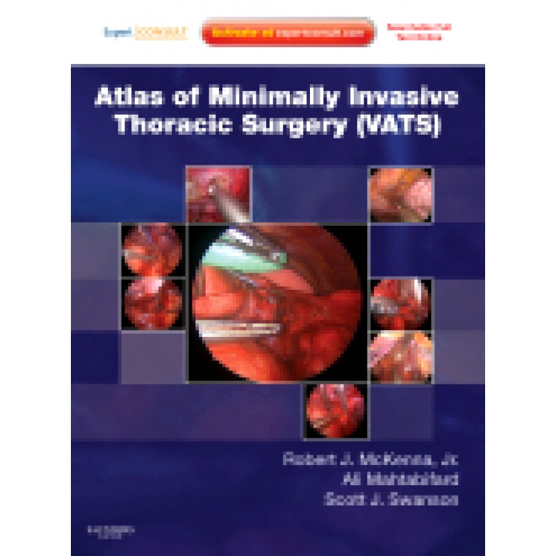 Atlas of Minimally Invasive Thoracic Surgery (VATS) - Online and Print, with DVD // ΕΞΑΝΤΛΗΜΕΝΟ ΣΤΟΝ ΕΚΔΟΤΗ