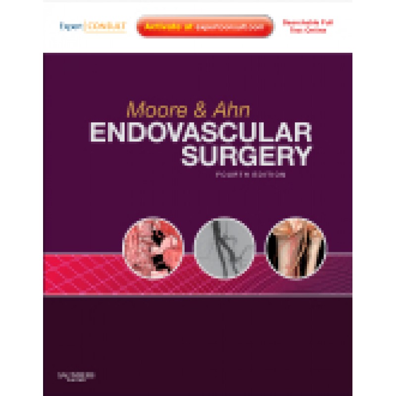 Endovascular Surgery, 4th Edition - Online and Print, with Video