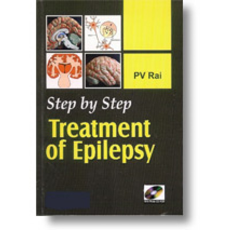 STEP BY STEP TREATMENT OF EPILEPSY