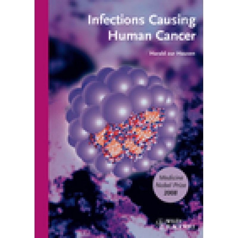 Infections Causing Human Cancer