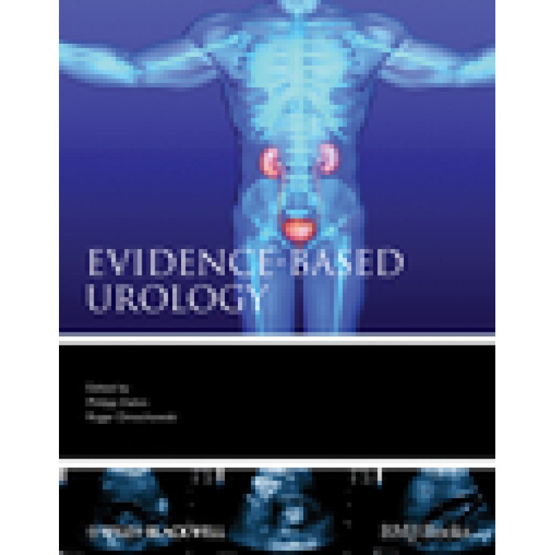 Evidence-based Urology