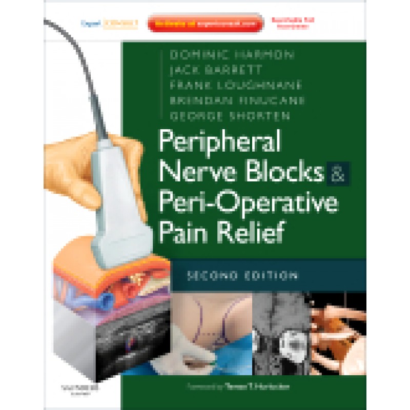 Peripheral Nerve Blocks and Peri-Operative Pain Relief, 2nd Edition - Expert Consult: Online and Print