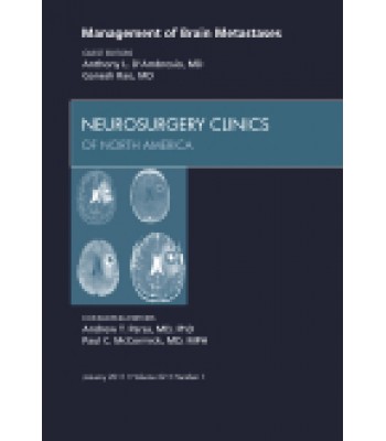 Management of Brain Metastases