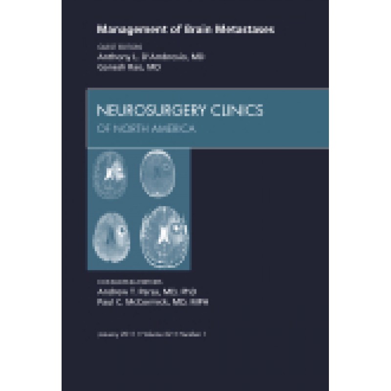 Management of Brain Metastases
