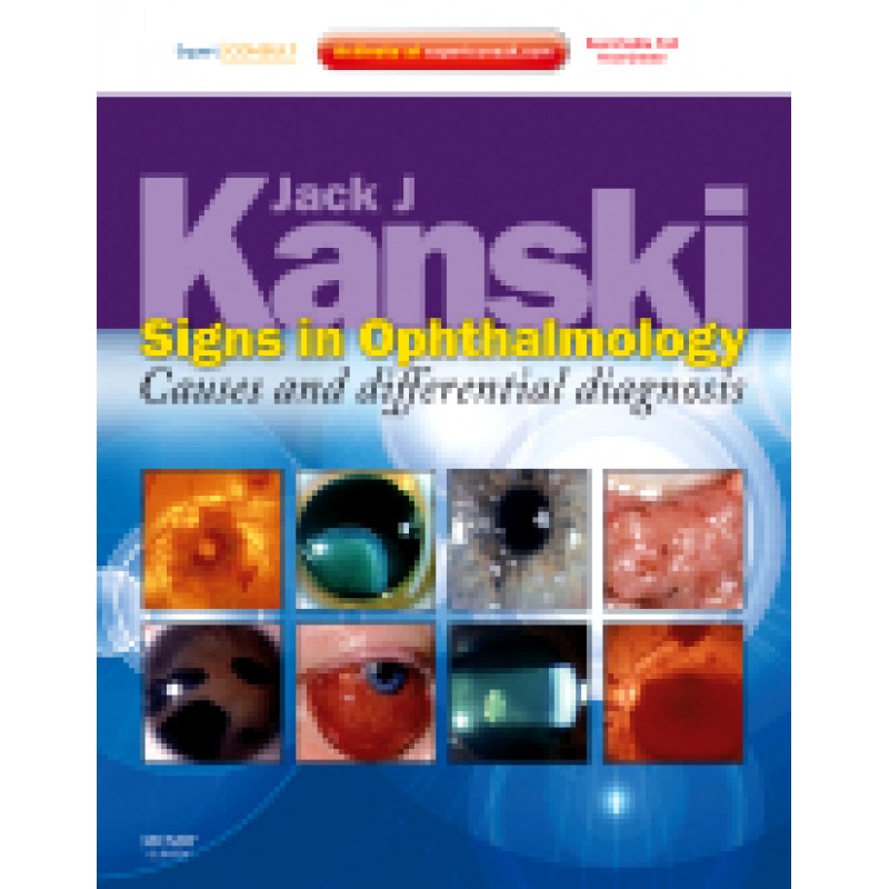 Signs in Ophthalmology: Causes and Differential Diagnosis - Expert Consult - Online and Print