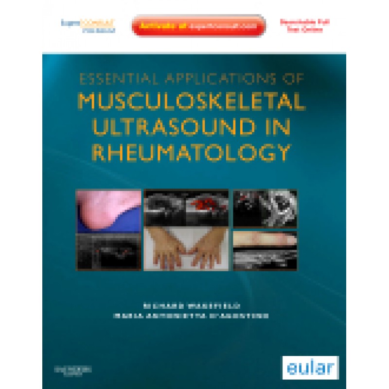 Essential Applications of Musculoskeletal Ultrasound in Rheumatology - Expert Consult Premium Edition: Enhanced Online Features and Print