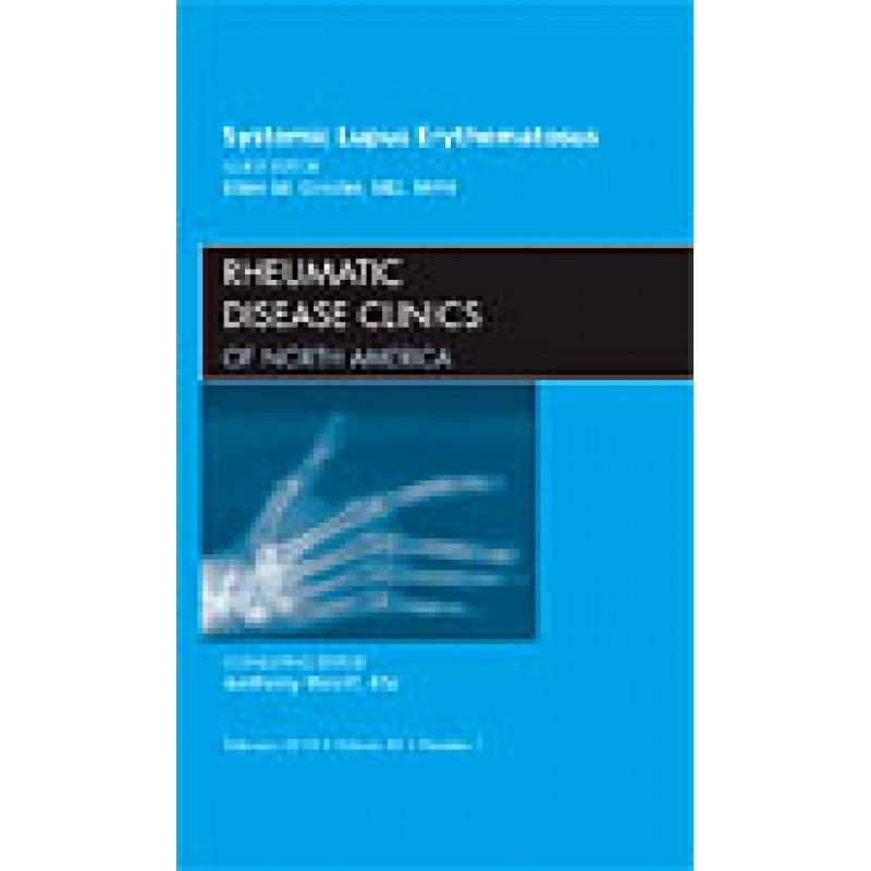 Systemic Lupus Erythematosus