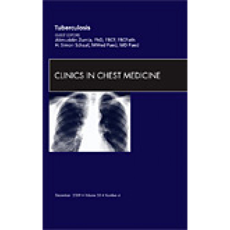 Tuberculosis