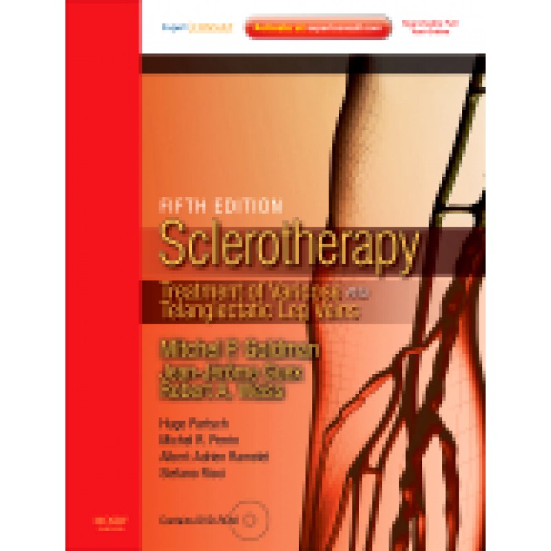Sclerotherapy Expert Consult - Online and Print, 5th Edition