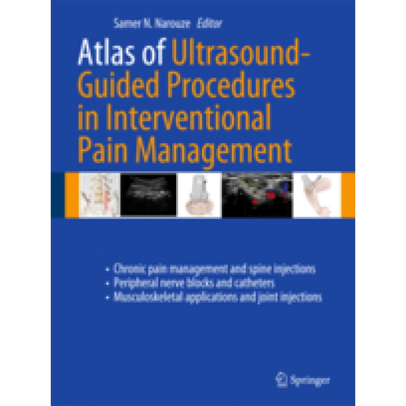 Atlas of Ultrasound-Guided Procedures in Interventional Pain Management