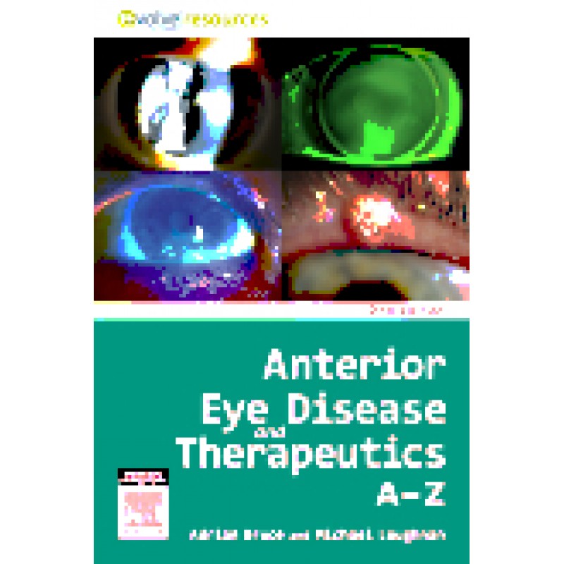 Anterior Eye Disease and Therapeutics A-Z, 2nd Edition