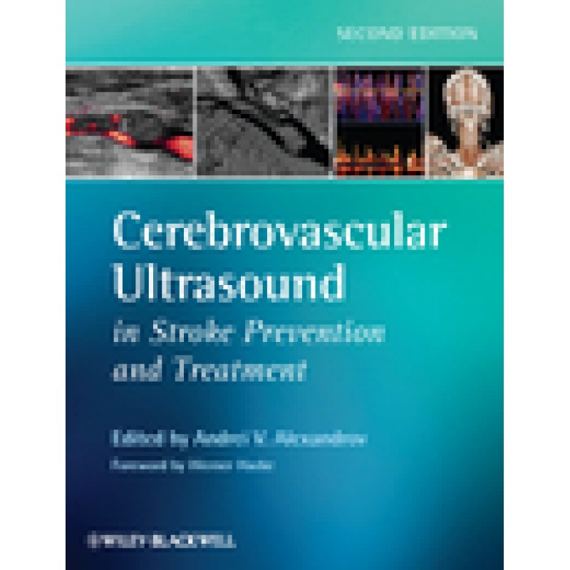 Cerebrovascular Ultrasound in Stroke Prevention and Treatment, 2nd Edition