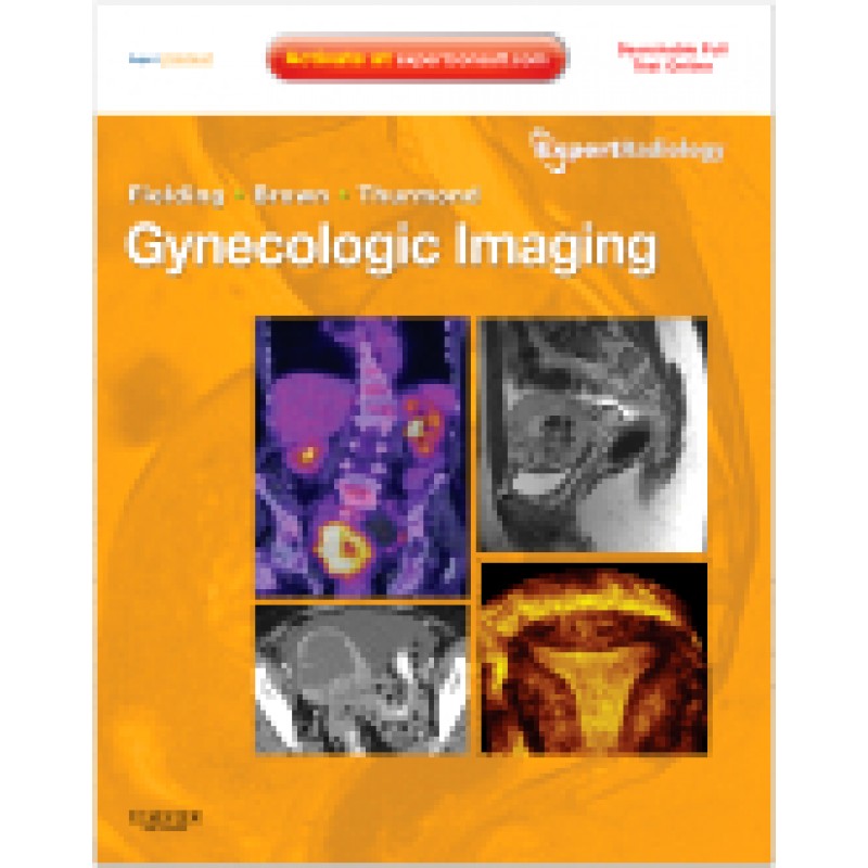 Gynecologic Imaging - Online and Print