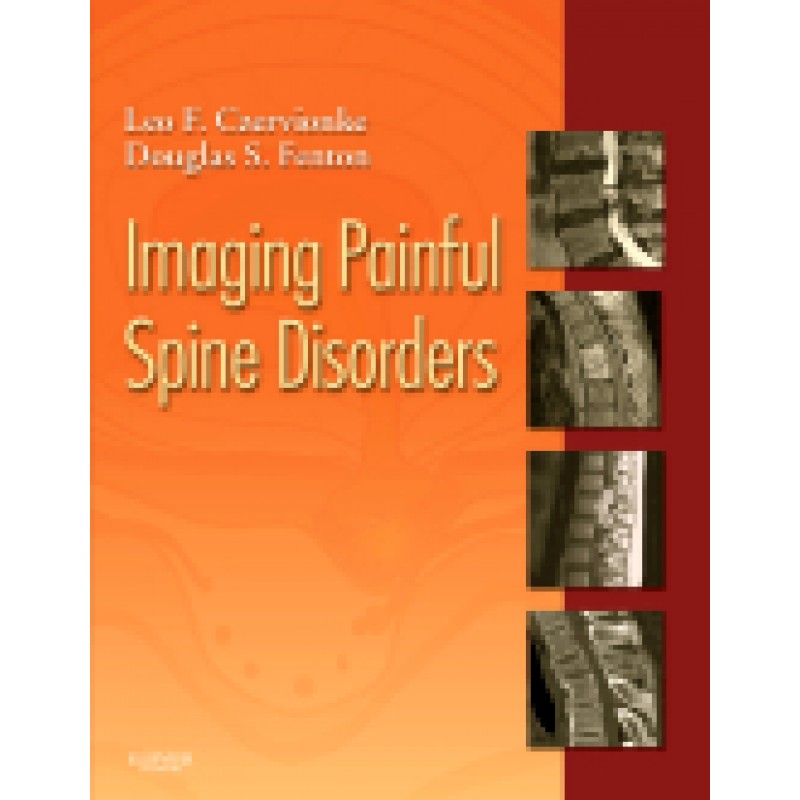 Imaging Painful Spine Disorders