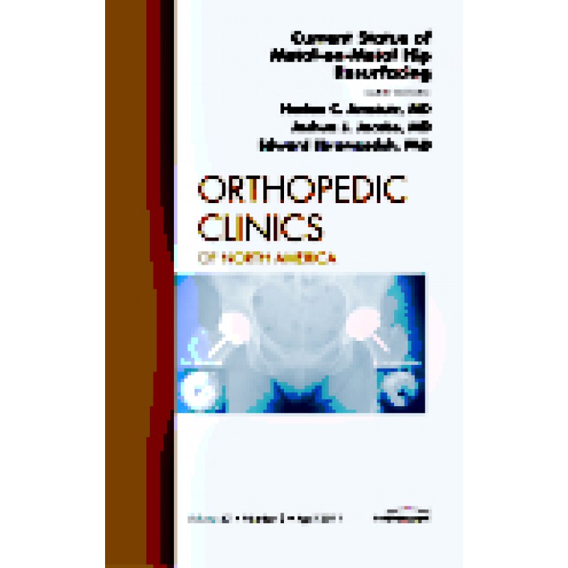 Current Status of Metal-on-Metal Hip Resurfacing