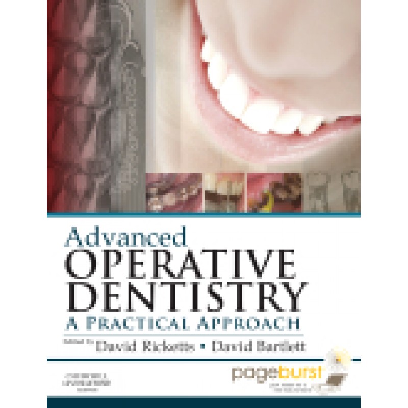 Advanced Operative Dentistry