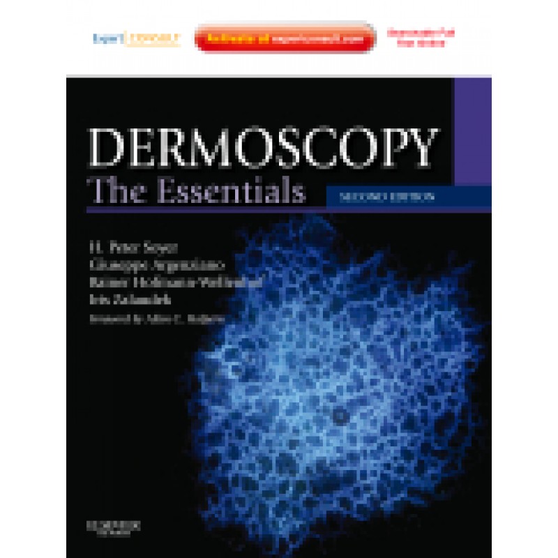 Dermoscopy 2nd Edition - The Essentials: Expert Consult - Online and Print