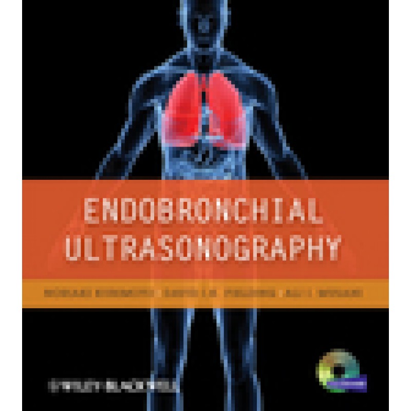 Endobronchial Ultrasonography