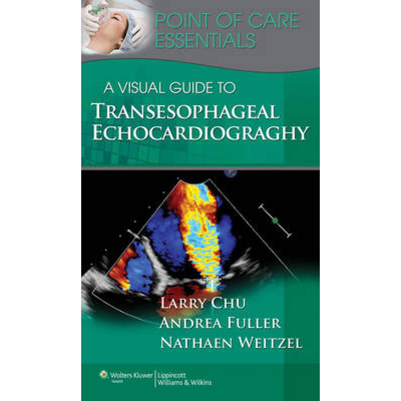 Visual Guide to Transesophageal Echocardiography