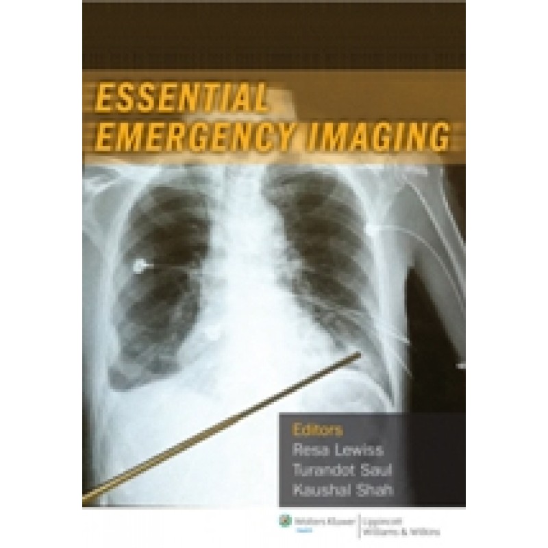 Essential Emergency Imaging