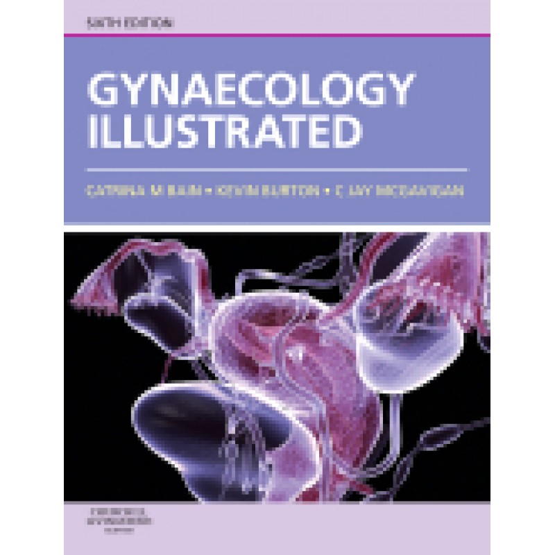 Gynaecology Illustrated, 6th Edition