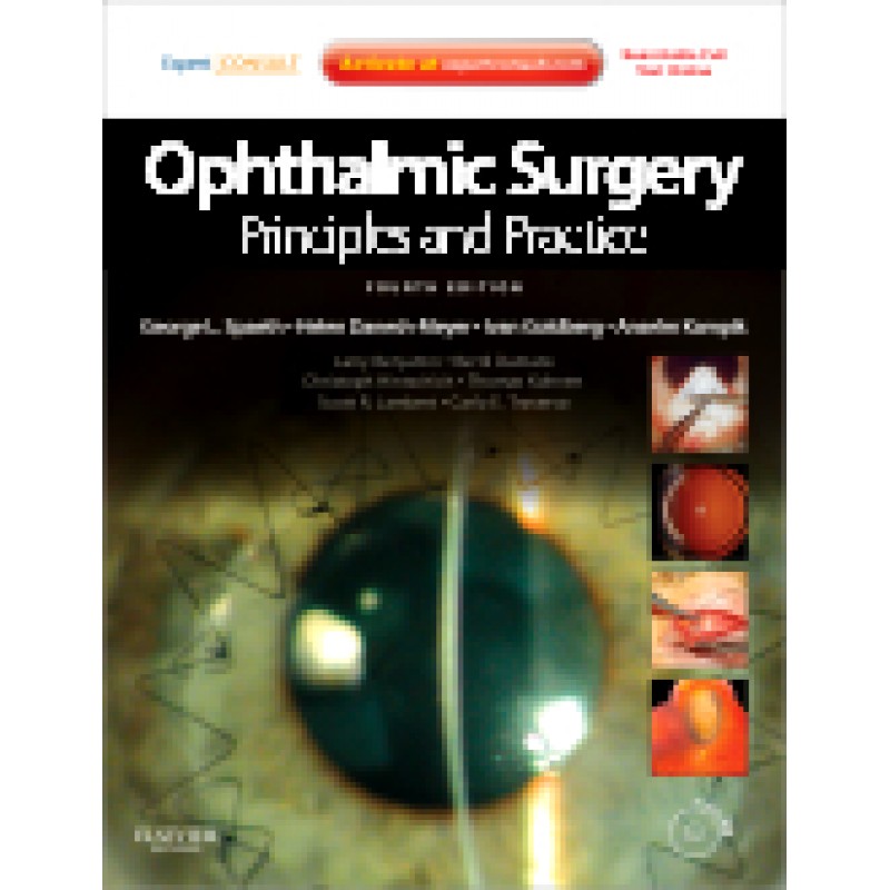 Ophthalmic Surgery: Principles and Practice, 4th Edition