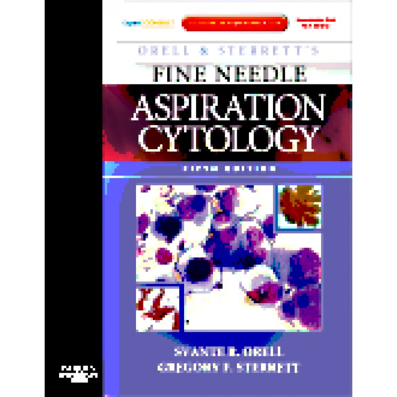 Orell and Sterrett's Fine Needle Aspiration Cytology, 5th Edition - Expert Consult: Online and Print