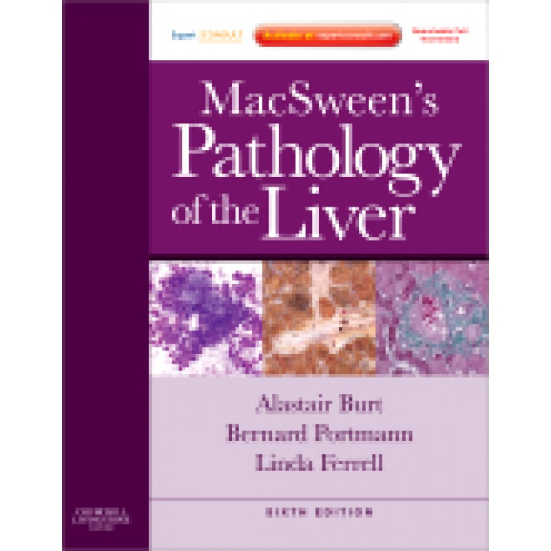 MacSween's Pathology of the Liver, 6th Edition - Expert Consult: Online and Print