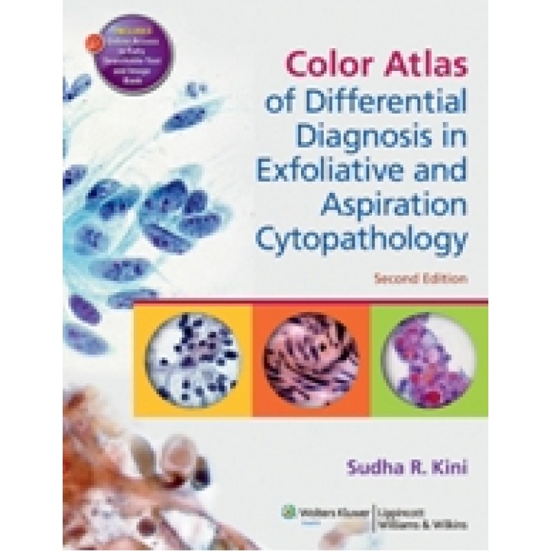 Differential Diagnosis in Exfoliative and Aspiration Cytopathology: An Atlas and Text , 2nd edition