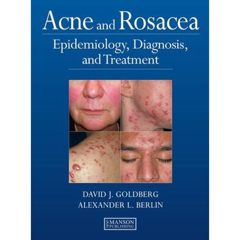 Acne and Rosacea