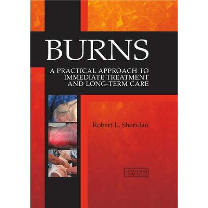 Burns - A Practical Approach to Immediate Treatment and Long Term Care