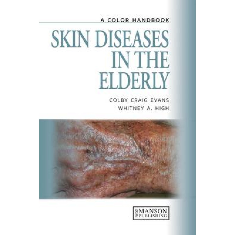 Skin Diseases in the Elderly - A Color Handbook