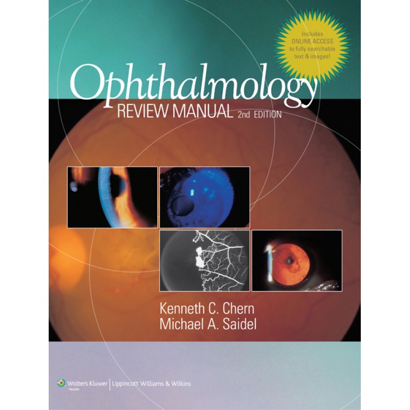 Ophthalmology Review Manual 2nd edition