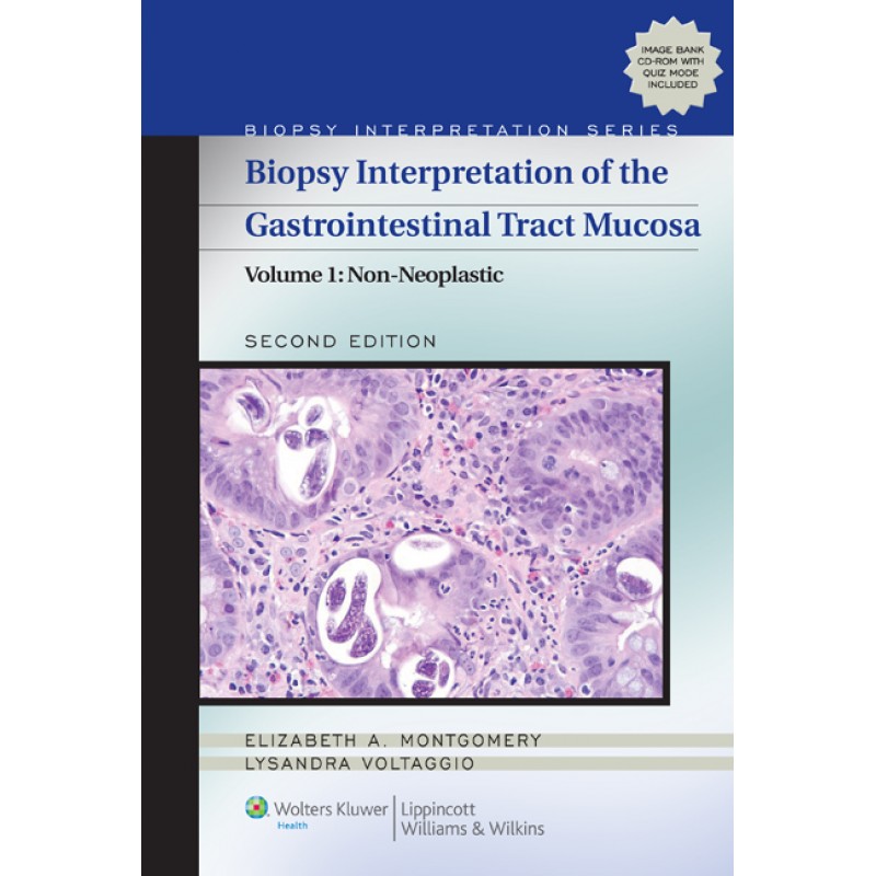 Biopsy Interpretation of the Gastrointestinal Tract Mucosa 2nd edition