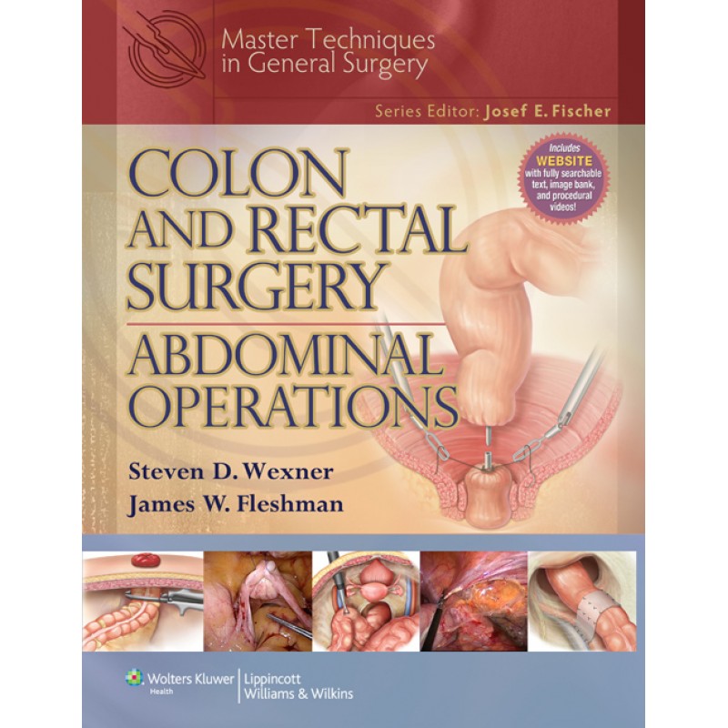 Master Techniques in General Surgery: Colon and Rectal Surgery: Abdominal Operations